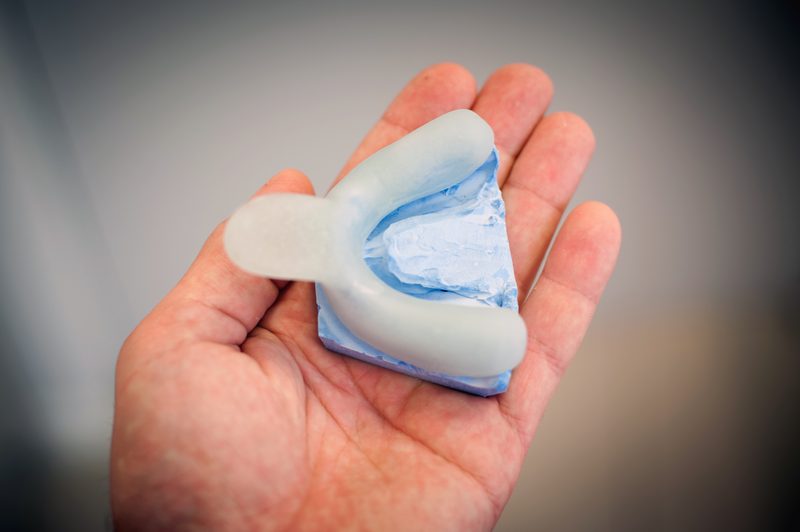 Special impression tray custom dental lab Sydney